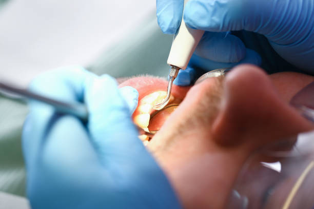 Best Emergency Treatment for Oral Infections in Brooklyn, NY